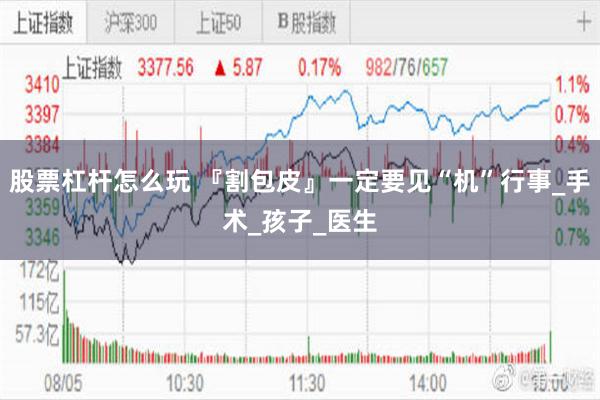 股票杠杆怎么玩 『割包皮』一定要见“机”行事_手术_孩子_医生